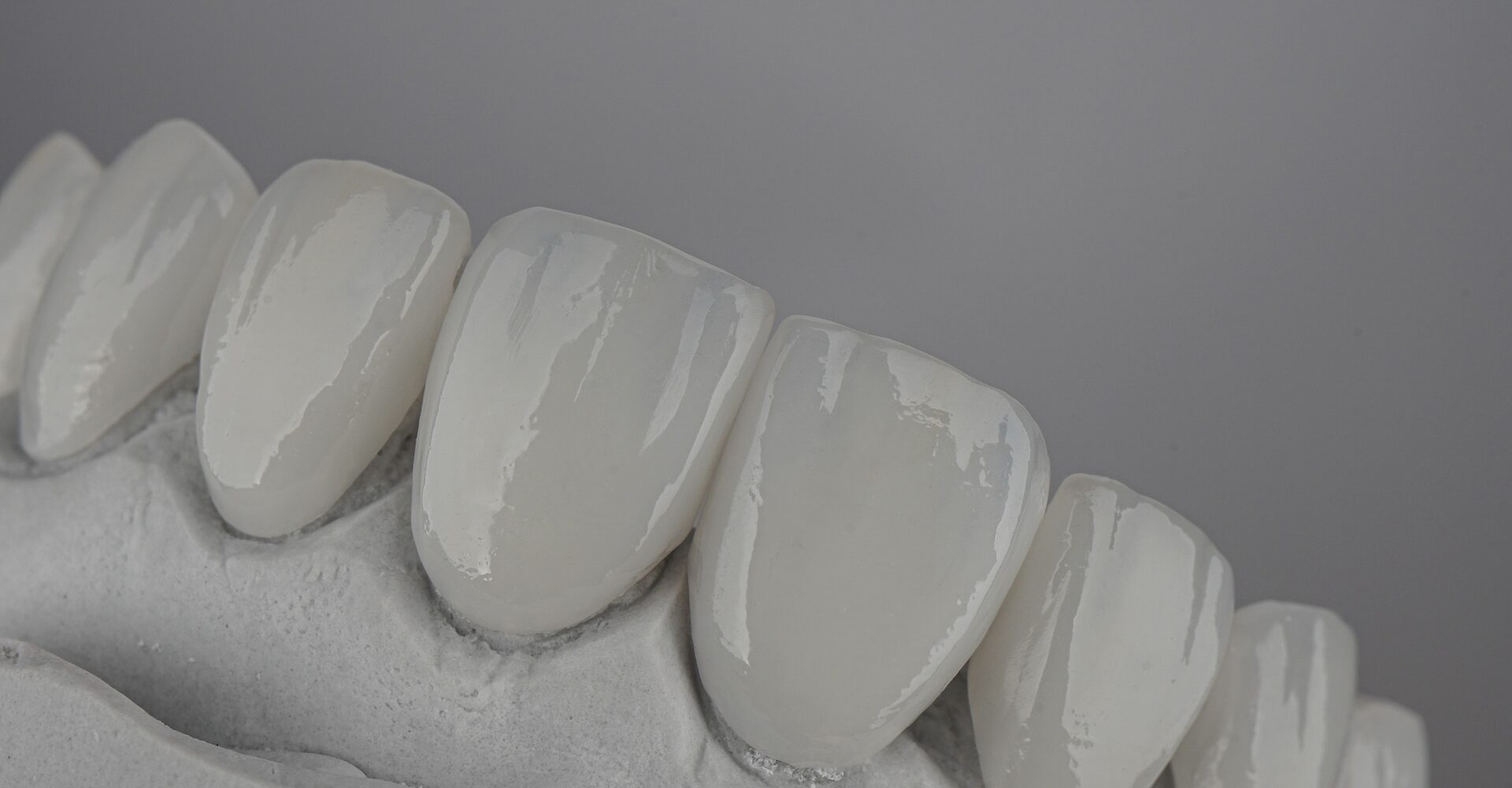 Veneers Smile Manchester